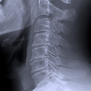 Radiografía (2 proyecciones) de columna o extremidades superiores o inferiores